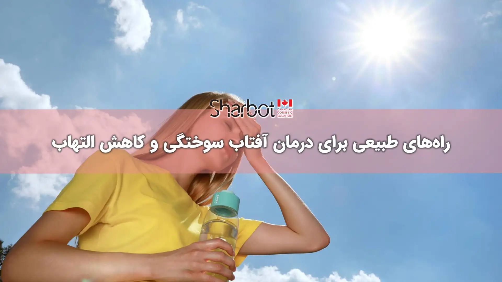 راه‌های طبیعی برای درمان آفتاب سوختگی و کاهش التهاب